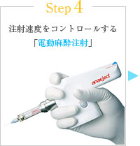 Step4 注射速度をコントロールする「電動麻酔注射」
